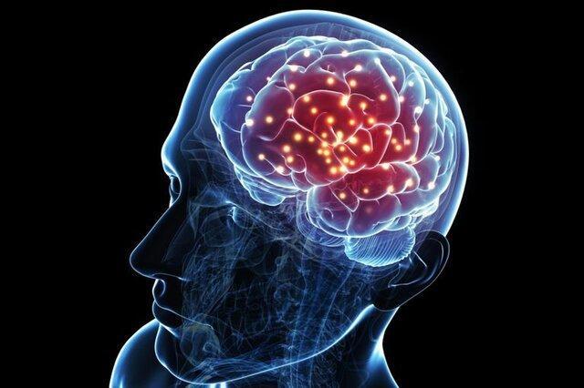 از دست رفتن نورون ها می تواند به سکته مغزی منجر شود از دست رفتن نورون ها می تواند به سکته مغزی منجر گردد