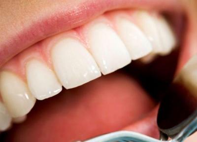 10 عادت اشتباه که موجب نابودی دندان می گردد